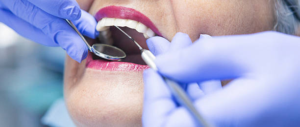 Best Emergency Dentist for Knocked-Out Tooth in Wise, VA